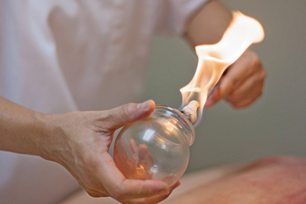 Cupping therapy treatment